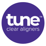 Tune Aligners Romania